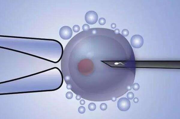 试管婴儿胚胎移植成功率高吗，试管新鲜胚胎移植成功率高吗